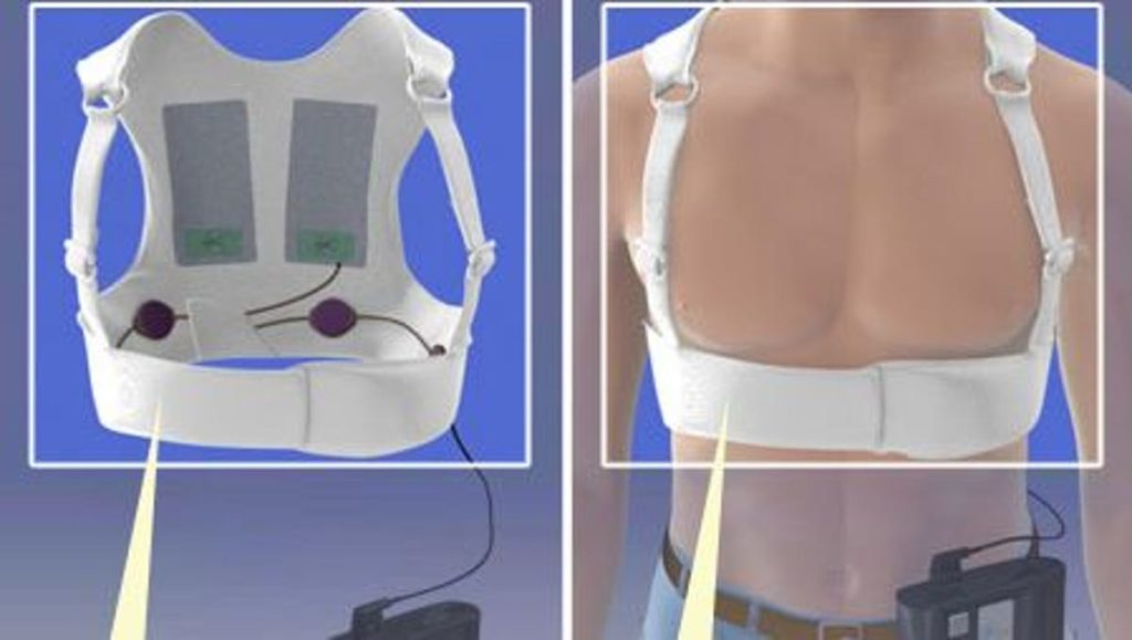 What does a ZOLL LifeVest do?